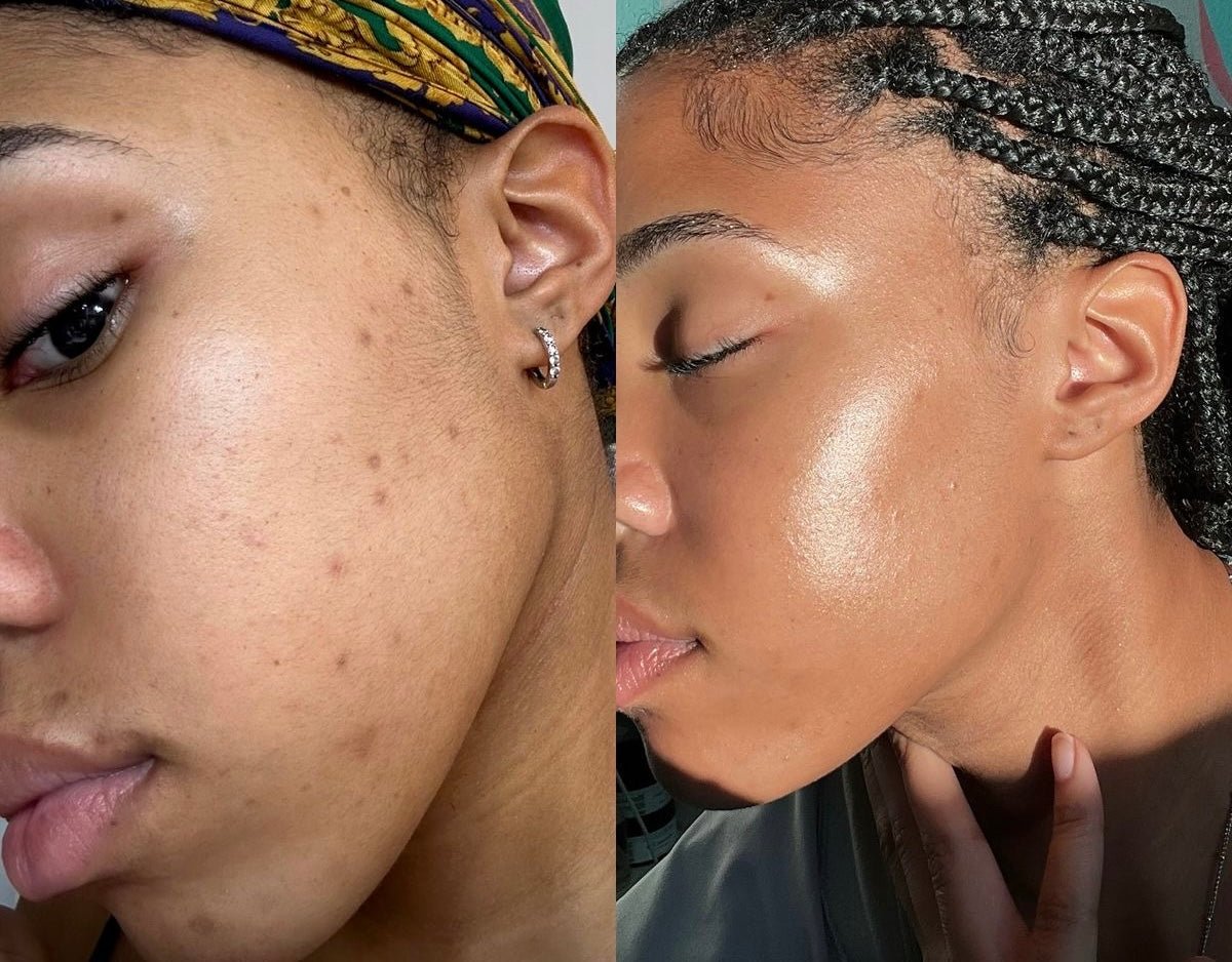 Masque moussant au curcuma - BUBBLE SKIN
