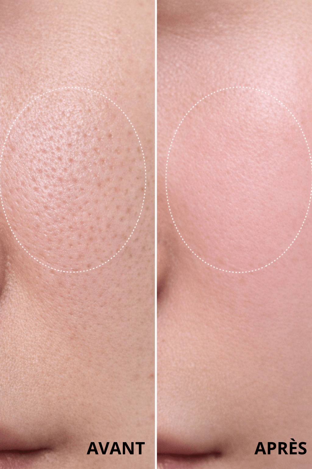 Masque Nettoyant Moussant au Basilic Sacré - BUBBLE SKIN