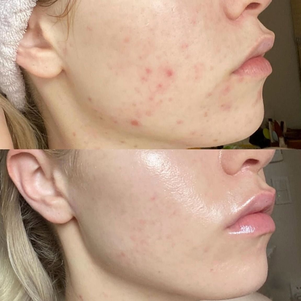 Masque Nettoyant Moussant au Basilic Sacré - BUBBLE SKIN